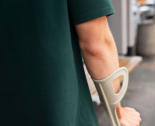 injured Person walking with Crutch